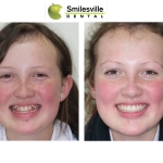 Invasalign Orthodontics Christchurch