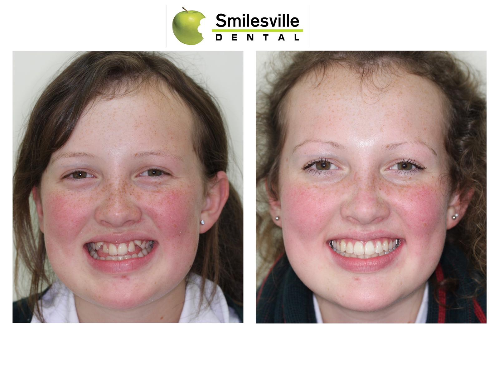 Invasalign Orthodontics Christchurch