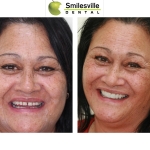 Dentists Christchurch Orthodontics and Invisalign Treatments