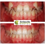 Dentists Christchurch Orthodontics and Invisalign services.