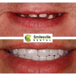 Christchurch orthodontics and Invisalign services.