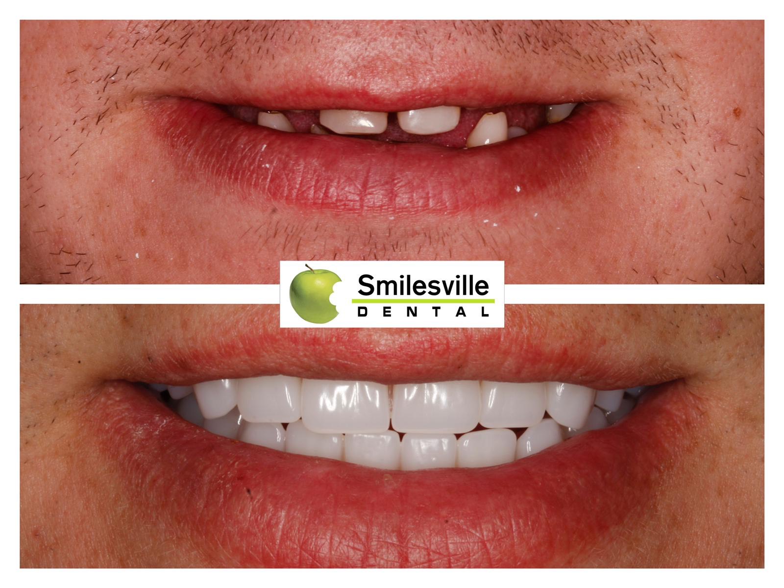 Christchurch orthodontics and Invisalign services.