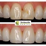 Dentists Christchurch Smilesville Dental Riccarton Christchurch