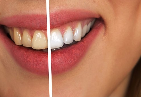 Cosmetic Dentists Christchurch, Smilesville Dental Riccarton Road Christchurch