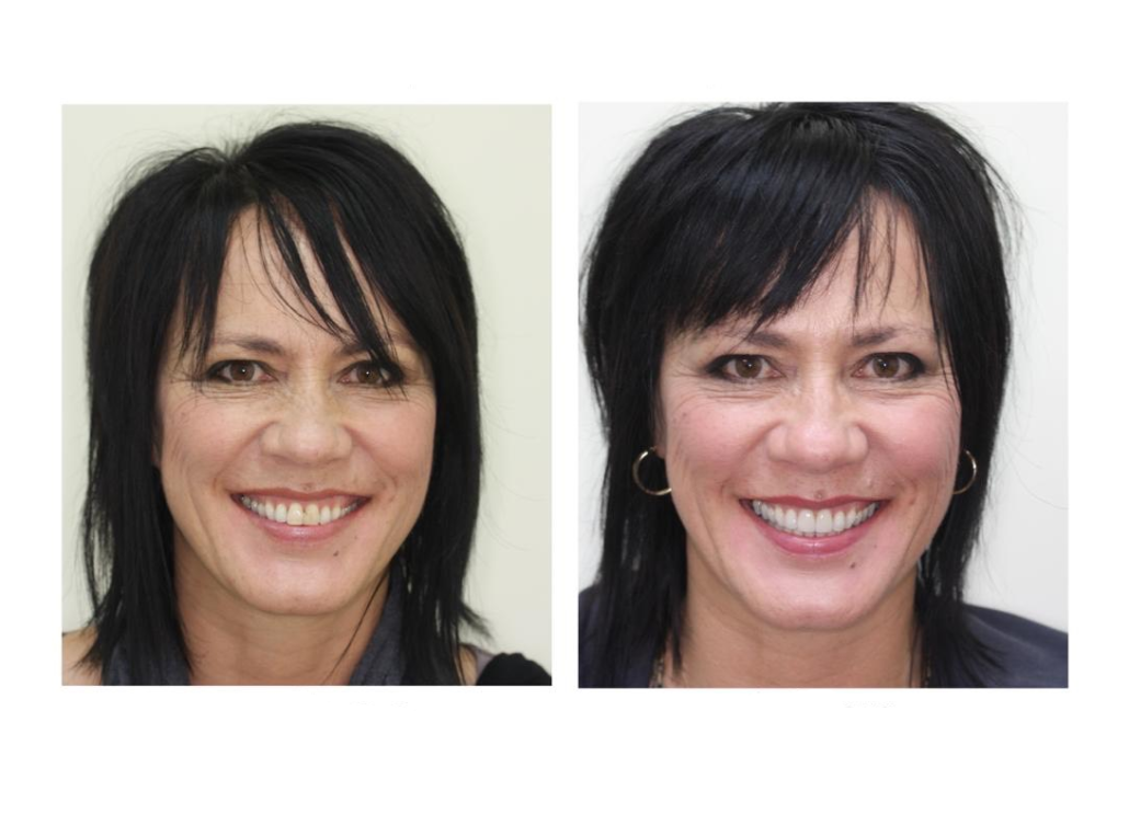 Dentist Christchurch – Orthodontist Christchurch – Invisalign Treatment Christchurch