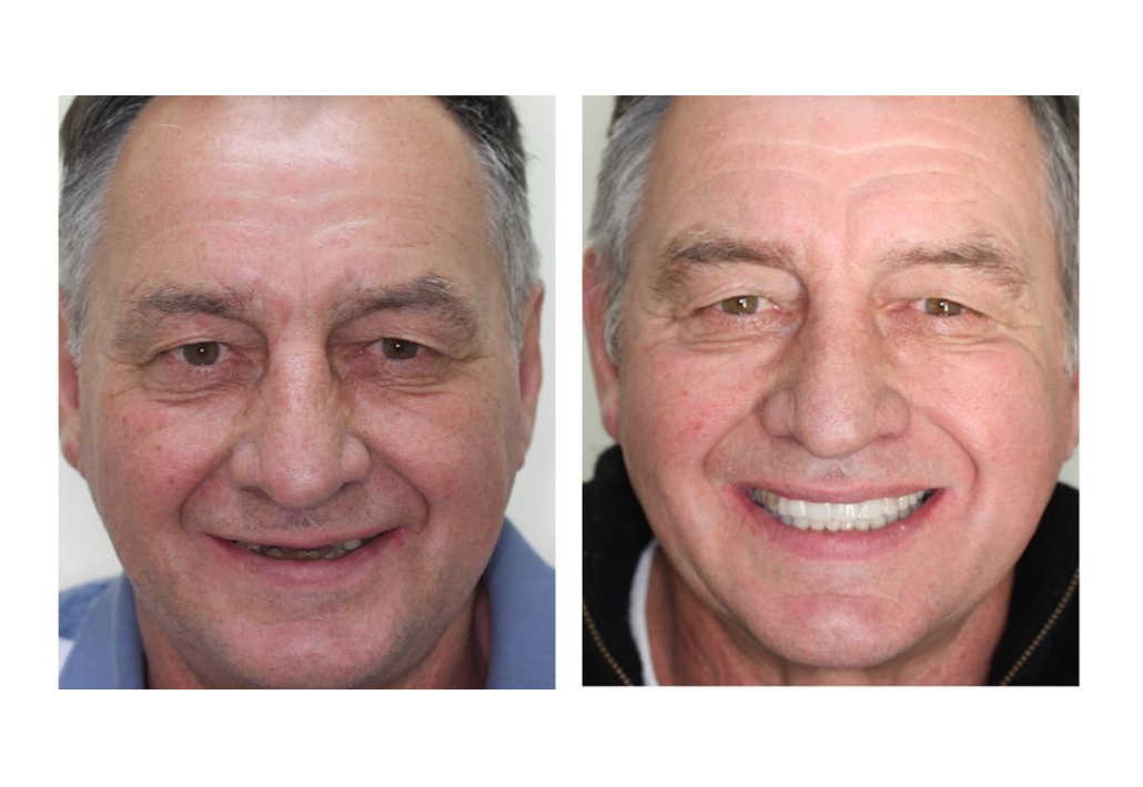 Dentist Christchurch – Orthodontist Christchurch – Invisalign Treatment Christchurch - Smilesville Dental Christchurch
